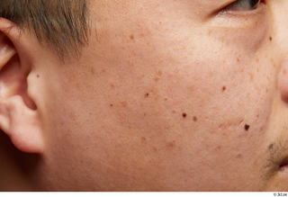 HD Face Skin Nui Thay cheek ear face skin pores…